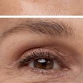 Dermal Fillers: A Guide to Enhancing Your Look